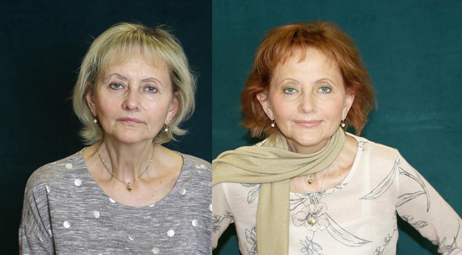 žena 62 let foto bez retuší